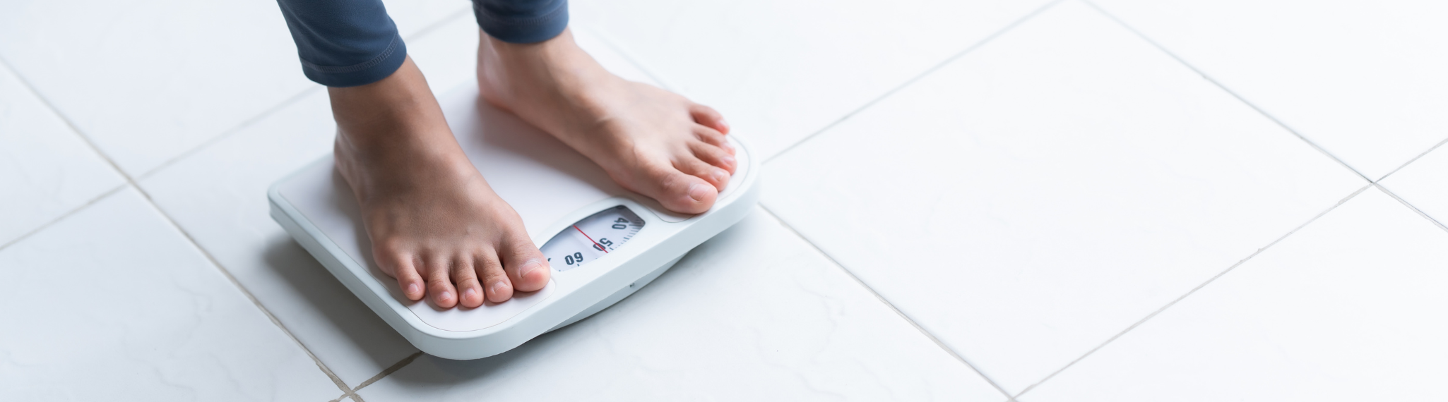 aumento peso hipotiroidismo sintoma