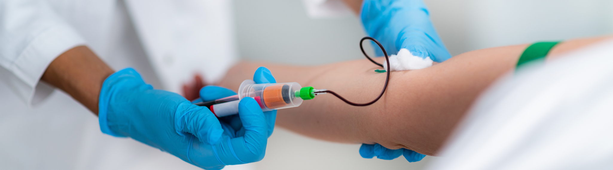 examen sangre glucosa insulina ayunas